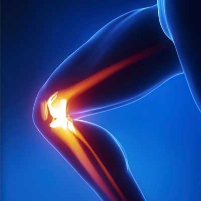 osteoarthridida-gonato